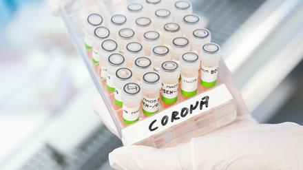 Eine biologisch-technische Assistentin zeigt aufbereitete PCR-Tests auf das Corona-Virus von Patienten im PCR-Labor.