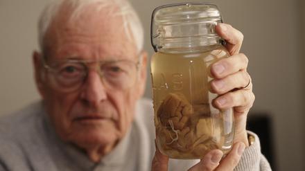 Der Pathologe Thomas Harvey Präsentiert 1994 in Kansas Einsteins Hirn in einem Glas. 