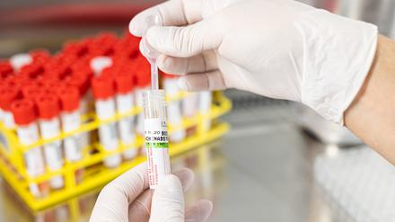 Ein Biologielaborant bereitet eine Probe von einem Rachenabstrich für einer Infektion mittels PCR vor. 