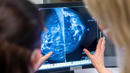 Bei Frauen ist Brustkrebs die verbreitetste Form, gefolgt von Lungen- und Darmkrebs. Bei Männern war Lungenkrebs die häufigste Form, gefolgt von Prostata- und Darmkrebs.