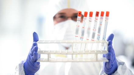 Ein Labor-Mitarbeiter hält einen Ständer mit diversen Rachenabstrichröhrchen in den Händen.